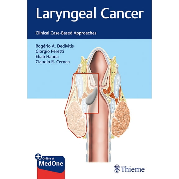 Laryngeal Cancer: Clinical Case-Based Approaches (Hardcover)