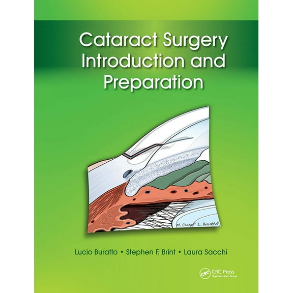Cataract Surgery: Introduction and Preparation, (Hardcover)