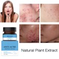 thumbnail image 3 of Crema facial crema facial Primple de 30 ml nutritiva para pieles grasas ANGGREK Otros, 3 of 8