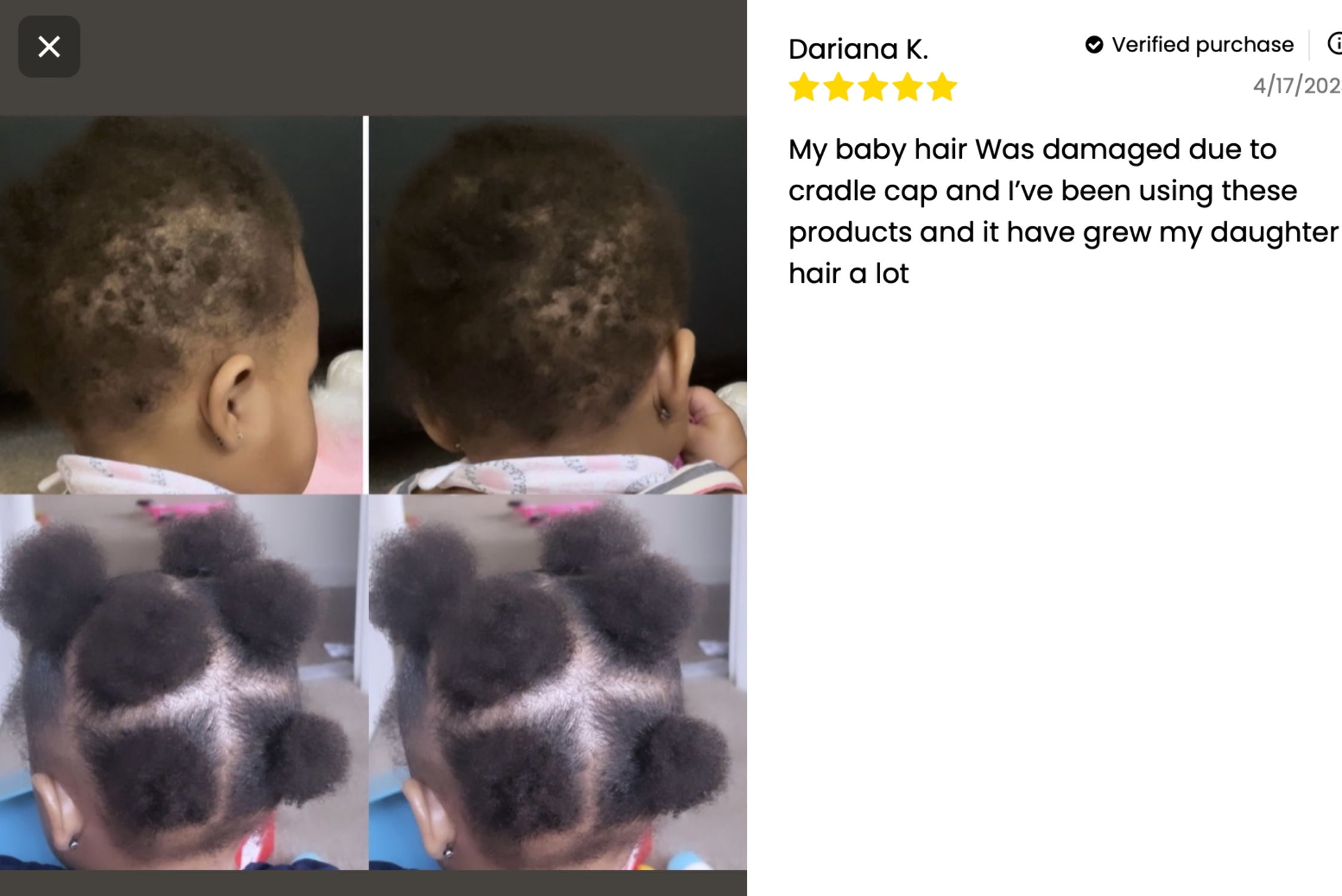 J'Organic Solutions Kid's Hair Care Kit
