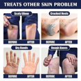 thumbnail image 2 of 1pc Jaysuing Anti-crack Repair Hand Cream Exfoliate To Improve Cracked And Rough Skin Moisturizing Moisturizing Hand Cream, 2 of 4