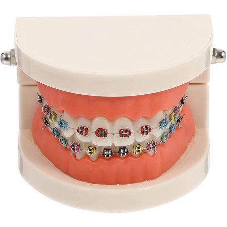Jual New Dental Typodont Orthodontic Model Half Self Ligating Normal Metal Bracket Comparison Ortho Teeth Model With Braces For Teaching I.1538229574 Jual New Dental Typodont Orthodontic Model Half Self Ligating Normal Metal Bracket Comparison Ortho Teeth Model With Braces For Teaching I.1538229574
