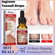thumbnail image 3 of Ingrown Toenail Treatment Serum Nail Correction Recover Oil Pain Relieve Ingrown Toenail Correction, 3 of 5