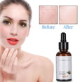 thumbnail image 3 of Moisturizing Skin Essence  Anti Aging Essence  Skin Essence  Facial Essence  Snail Secretion  30ml Hyaluro Serum Snail Secretion Moisturizing Nourishing Skin Essence Face Anti ANGGREK Skin Essence, 3 of 8