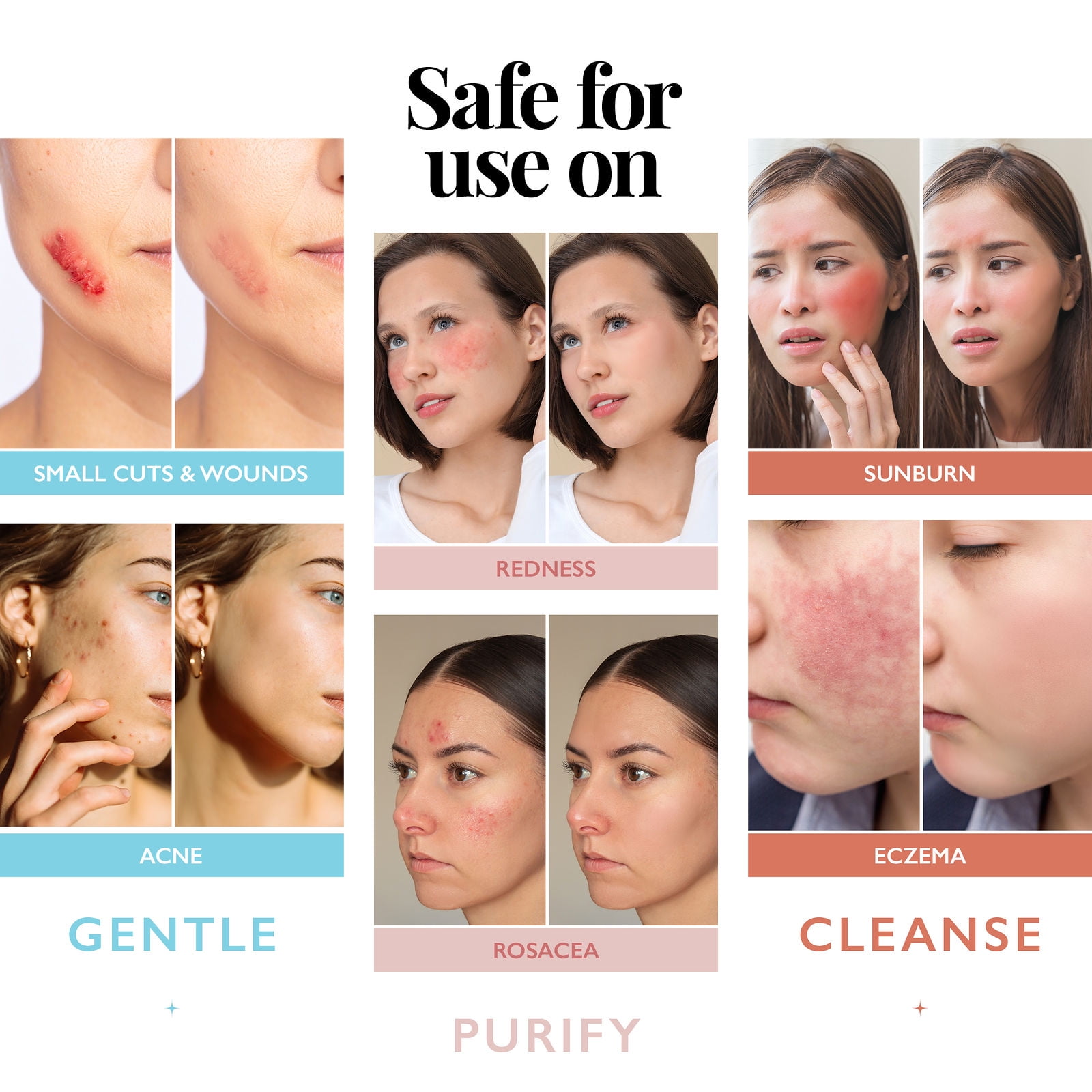 Hypochlorous Acid Spray for Face and Skin; Facial Cleanser | 8oz Face Mist Hypochlorous Acid Spray for Skin, Acne, Rash, Eczema, Wound | Aquia Antimicrobial Facial Cleanser Acne Sprays; Smart Skincar