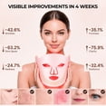 thumbnail image 3 of Morfone Led Face Mask, 4 Modes Red Light Mask for Face, LED Facial Mask with Timer, Home & Travel Skincare (Pink), 3 of 11