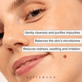 thumbnail image 3 of Asterwood Hypochlorous Acid Face Spray, Multi-Purpose Skin Repair Mist for Acne, Redness, and Irritation, 4 fl oz, 3 of 9