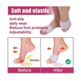 thumbnail image 3 of Toe Separator, Bunion Corrector, Toe Straightener, Metatarsal Pads, Bunion Corrector Cushion, for Straighten Overlapping Toes, Hammer Toe, Calluses, B, 3 of 5