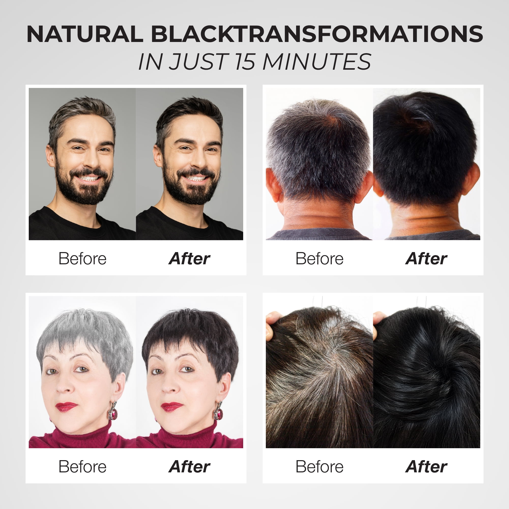 Abera Hair Dye Shampoo, Black Hair Color for Gray Coverage, Women & Men, Fade-Resistant, 10.1 fl oz