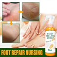 thumbnail image 2 of Foot peeling mask spray Dead skin remover heel Callus feet exfoliating, 2 of 5