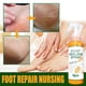 thumbnail image 2 of 100ml Foot Peeling Spray Natural Orange Essence Pedicure Foot Hand Dead Skin Exfoliator Whiten Foot Care Spray, 2 of 5