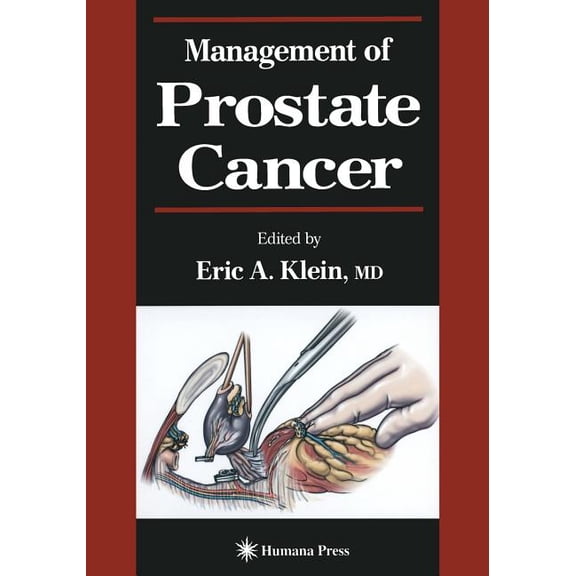 Current Clinical Urology Management of Prostate Cancer, (Paperback)