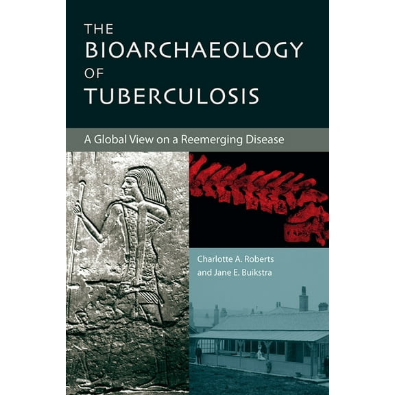 The Bioarchaeology of Tuberculosis: A Global View on a Reemerging Disease, (Paperback)