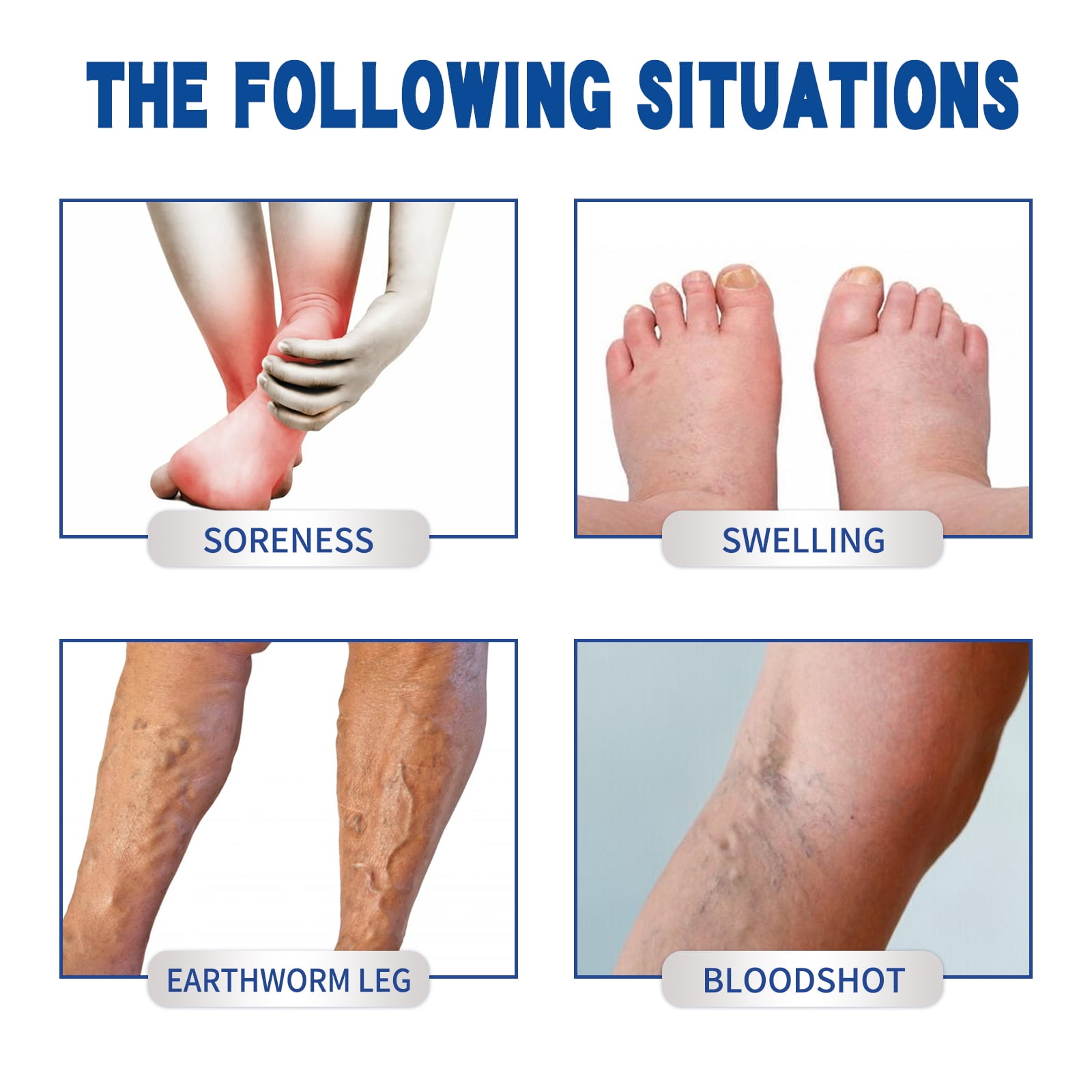 Alvantor Veins Cream for Leg Spider Vein Treatment with Rosemary Oil & Moisturizing Massage, 0.71oz