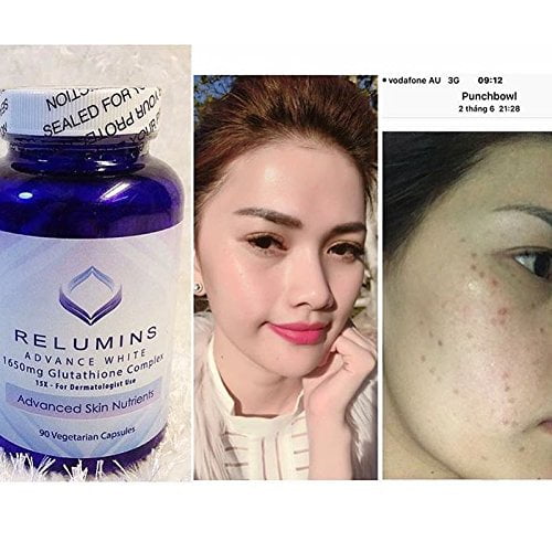 relumins 1650mg glutathione review Relumins Advance White 1650Mg Glutathione, Packaging Type: Bottle, Capsule  at ₹ 4000/bottle in Bhatkal main image 0