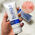 thumbnail image 4 of Removedor Limpiador De Acne Y Grasa Bioaqua Pure Skin UNIVERSOENLINEA.COM, 4 of 4