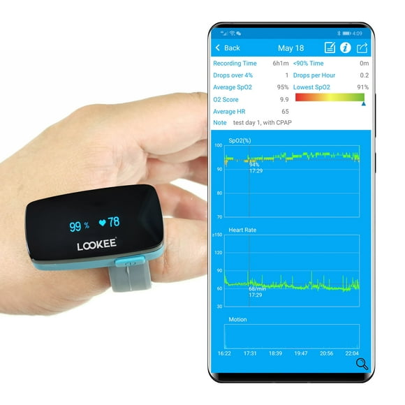 LOOKEE® Ring Sleep Oxygen Monitor with Vibration Alarm for Apnea Events & Low O2 | Overnight Pulse Oximeter Tracks Blood Oxygen Level and Heart Rate