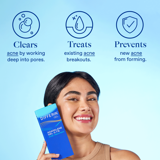 Differin Acne Treatment Gel, Retinoid Treatment for Face With 0.1%