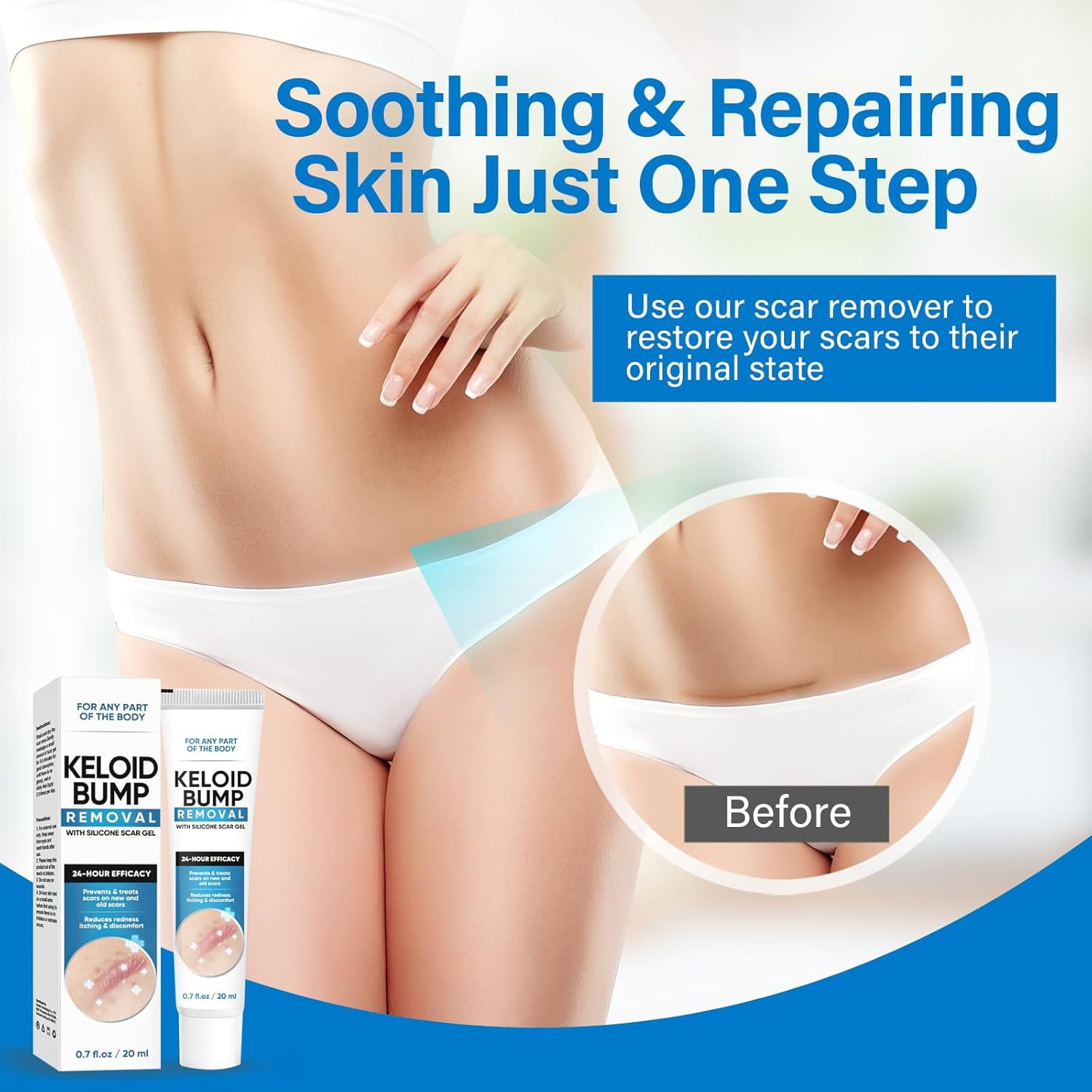Keloid Bump Removal Gel. Silicone Scar Treatment - Professional Scar Cream for Old & New Scars - 20ml