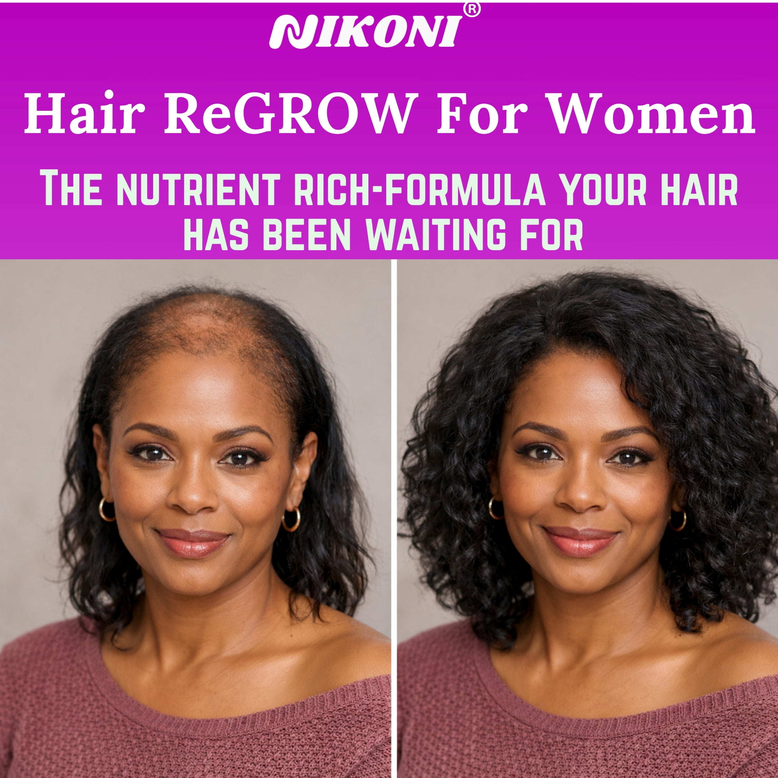 Nikoni Hair ReGROW Women's Liposomal Formula, Biotin, Keratin, Saw Palmetto and Botanical Essentials, Vegan, Gluten-Free, 60 Softgels