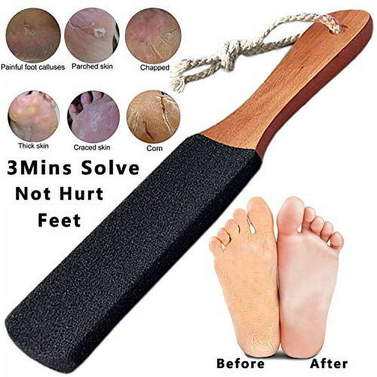 Pumice Valley  Foot Rasp Callus Remover - Pedicure Scrubber for Cracked  Feet Mixed Grained