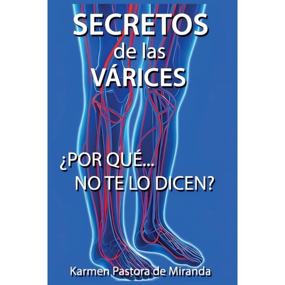 Secretos de las Varices: ¿Porque no te lo dicen?, (Paperback)