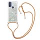 thumbnail image 5 of Funda FOXDOCK para Motorola Moto G Pure con Cuerda Ajustable, Brillo Líquido, Protección Antigolpes y Lente – Ideal para Regalo, 5 of 6