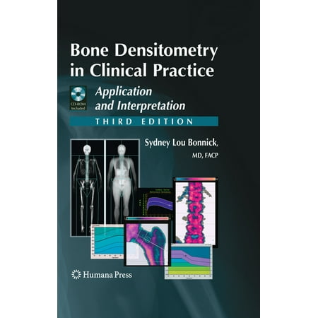 Current Clinical Practice Bone Densitometry in Clinical Practice: Application and Interpretation (Paperback)