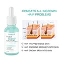 thumbnail image 4 of LANTHOME 30ml Razor Bump Solution Prevent Ingrown Hair Mild Moisturizing Shave Repair, 4 of 8