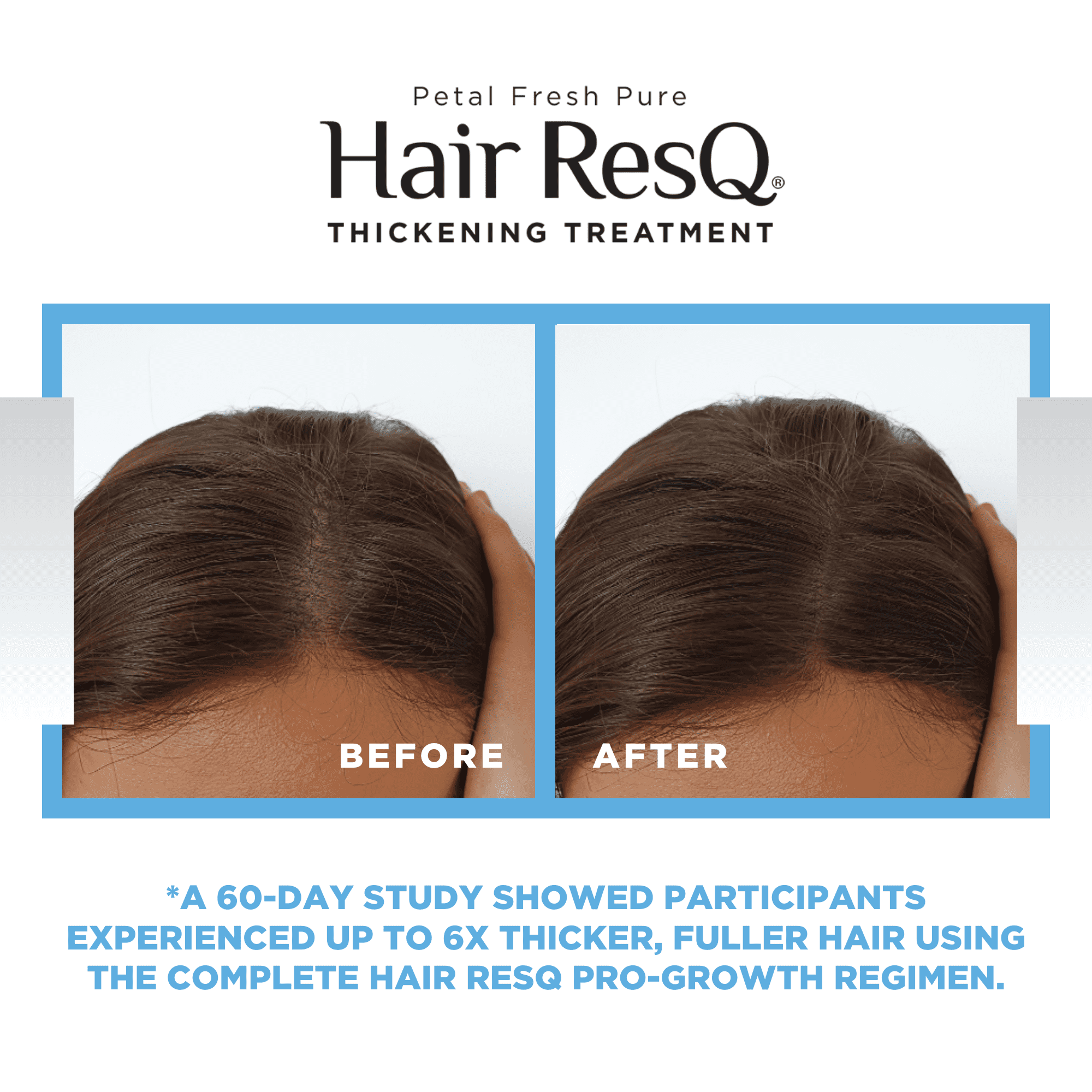 Petal Fresh Pure Hair ResQ Thickening Biotin Activation Pro-Growth Serum, 5oz