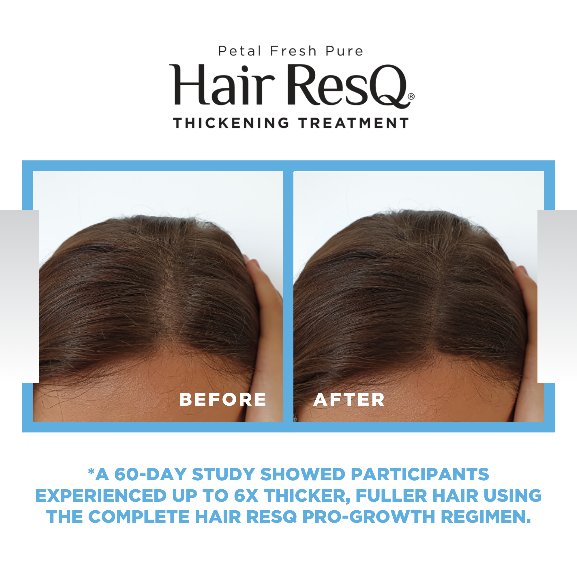Petal Fresh Hair ResQ Pro-Growth Serum With Biotin photo 4
