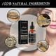 thumbnail image 4 of 2pcs Hair Growth Serum For Hair Loss And Hair Regrowth 30ml Ginger Hair Growth Oil For Thinning Balding Repairs Hair Follicles Hair Growth Treatment F, 4 of 5