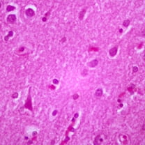 Human Cerebral Cortex, Sec. 7 To 8 M H&E Stain Microscope Slide