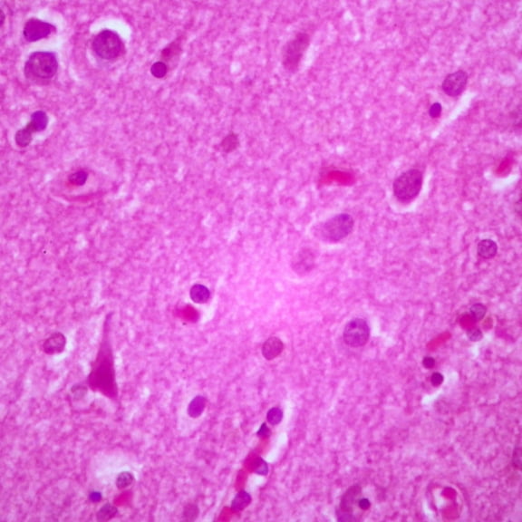 Human Cerebral Cortex, Sec. 7 To 8 M H&E Stain Microscope Slide