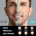 thumbnail image 6 of COSLUS Facial Cleansing Brush,Face Scrubber,Silicone Face Wash Brush,5 Cleansing Modes,Electric Deep Cleaning for Men Women, 6 of 12