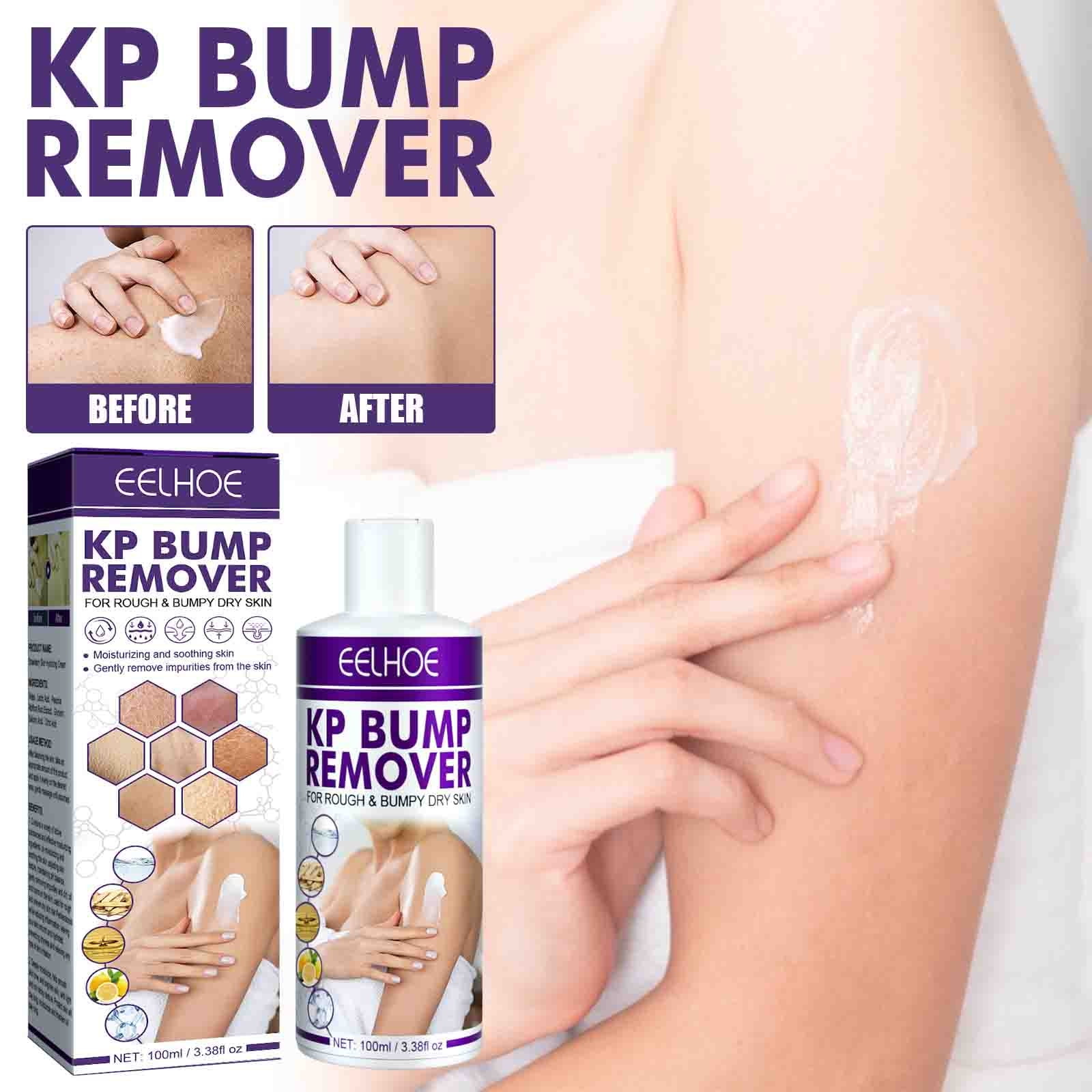 Herrnalise KP Bumps Be Gone Hydrating Cream, Moisturizing Cream For