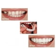 thumbnail image 2 of Dientes falsos, dentadura postiza, carillas temporales a presión, cubren los dientes imperfectos, arreglan una sonrisa segura, dientes falsos temporales, 2 of 5
