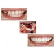 thumbnail image 2 of Dientes falsos, dentadura postiza, carillas temporales a presión, cubren los dientes imperfectos, arreglan una sonrisa segura, dientes falsos temporales, 2 of 5