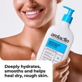 thumbnail image 3 of Amlactin Intensive Healing Body Lotion For Dry Skin, 7.9 Oz, 3 of 11