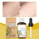 thumbnail image 4 of Fiudx Aceite Esencial de Acónito Aromático, Aceite para El Cuidado de La Depilación, Depilación Natural, Hidratación de La Piel, Ingredientes Calmantes, Piel Sensible, Aroma Fresco, Fácil Aplicación,, 4 of 6