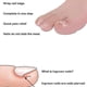 thumbnail image 4 of Ingrown Toenail Correction Kit, 50 Correctors, 5 Clippers, 6 Toe Protectors, 4 of 5