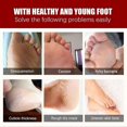 thumbnail image 4 of 5 Pairs Exfoliating Essence Foot Mask Moisturizing Hydrating Remove Dead Skin Skin-friendly, 4 of 5