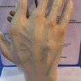 thumbnail image 5 of Modelo de Mano de Osteoartritis, Modelo de Patología de la Mano, Réplica de Anatomía y Fisiología , Modelo de Anatomía del Consultorio, 5 of 5