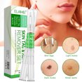thumbnail image 1 of Bolígrafo Removedor De Etiquetas De Piel Eliminador de etiquetas de piel portátil Pen Patch Wart Remove Acne Mole Treatment Tool Ndcxsfigh Cuidado Belleza, 1 of 8