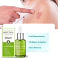 thumbnail image 2 of Clearance Now! Advanced Scar Repair Serum Effective For All Types Scars ∫∫ .ε of Including Z6A4, 2 of 9