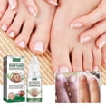 thumbnail image 2 of Essential Oil Nail Fungus Repair Liquid Nail Thickening Discoloration Off Soft Nail Thickening Type Onychomyc 20ml, 2 of 5
