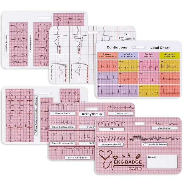 Lisol Ekg Cardiac Badge Card Juego De 3 Tarjetas Stemi Badge Card Ekg Telemetría Interpretación Badge Buddy Nurse 12 Lead Ecg Rate Tarjetas De Bolsillo Hoja De Trucos De Enfermería Con Regla De Ekg Me