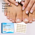 thumbnail image 4 of Parches De Corrección De Uñas Pegatinas de corrección de uñas Corrector de uñas encarnadas Parches Tratamiento de uñas Ndcxsfigh Cuidado Belleza, 4 of 8