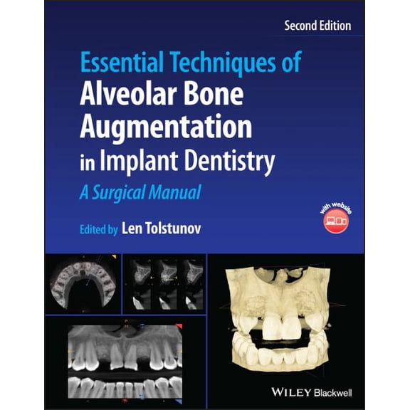 Pre-Owned Essential Techniques of Alveolar Bone Augmentation in Implant Dentistry: A Surgical Manual (Hardcover)