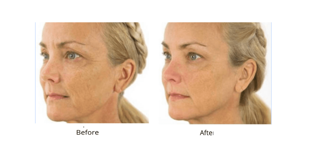 Dr. Sevinor’s NEW Genuine Facelift Solution Concentrated Serum Jumpstarts Tired Looking Skin, Diminishes Wrinkles/Lines Renews Skins Elasticity